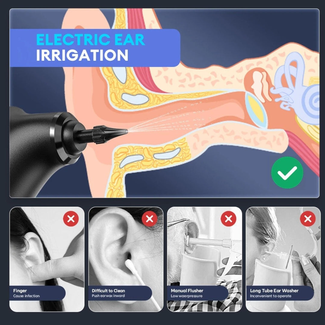 Sonique™ Ear Wax Remover